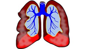 lungs 39981 960 720kopie